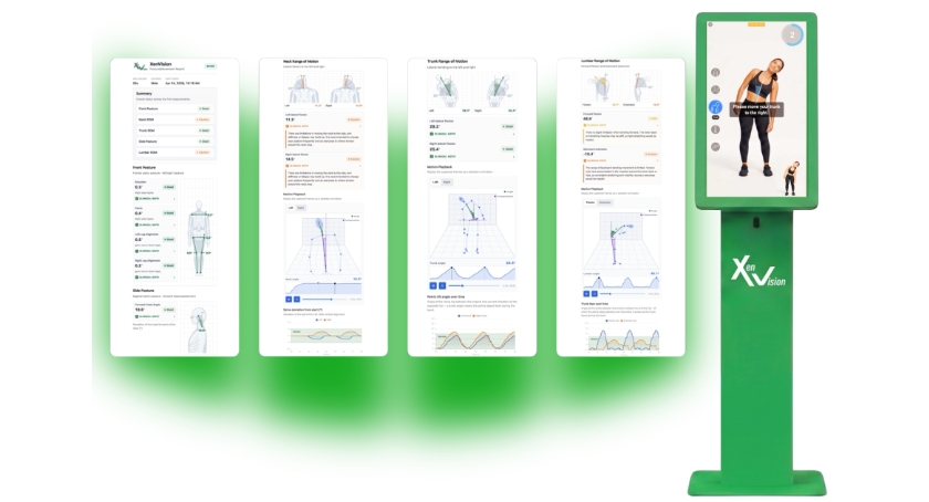 Xenco Medical Debuts AI-Driven Musculoskeletal Health Platform